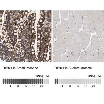 Anti-RIPK1 antibody produced in rabbit Prestige Antibodies&#174; Powered by Atlas Antibodies, affinity isolated antibody, buffered aqueous glycerol solution