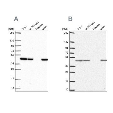 Anti-NDUFS2 antibody produced in rabbit Prestige Antibodies&#174; Powered by Atlas Antibodies, affinity isolated antibody, buffered aqueous glycerol solution