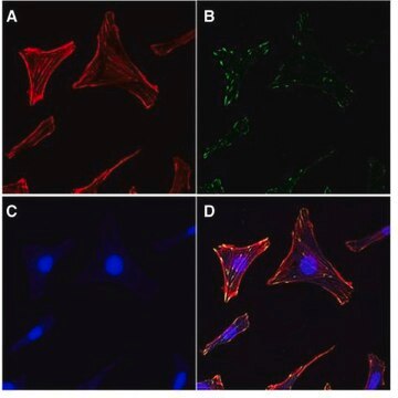 Aktinzytoskelett-/Fokaladhäsions-Färbungskit The Actin Cytoskeleton &amp; Focal Adhesion Staining Kit consists of TRITC-conjugated phalloidin, anti-Vinculin &amp; DAPI for the immunofluorescent staining of actin filaments in the cytoskeleton as well as the nucleus of the cells.