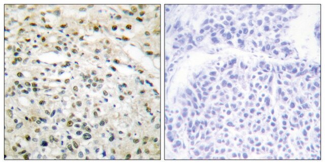 Anti-DNMT3B antibody produced in rabbit affinity isolated antibody