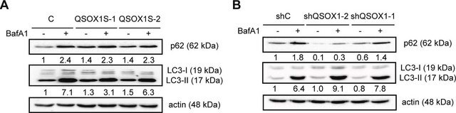 Anti-LC3 antibody produced in rabbit ~1&#160;mg/mL, affinity isolated antibody, buffered aqueous solution