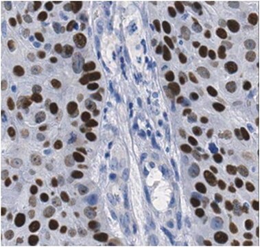 Anti-p40 Antibody from rabbit, purified by affinity chromatography