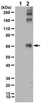 Anti-HNE Michael Adducts Antibody, Reduced serum, from rabbit