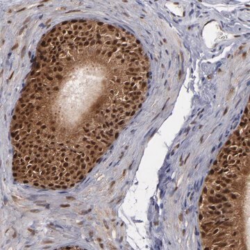 Anti-GSR antibody produced in rabbit Prestige Antibodies&#174; Powered by Atlas Antibodies, affinity isolated antibody, buffered aqueous glycerol solution