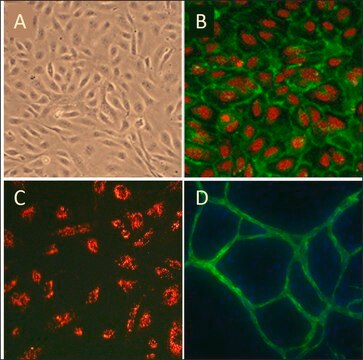 Human Umbilical Vein Endothelial Cells: HUVEC, neonatal, pooled