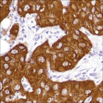 Anti-EGFR antibody, Rabbit monoclonal clone SP111, recombinant, expressed in proprietary host, affinity isolated antibody