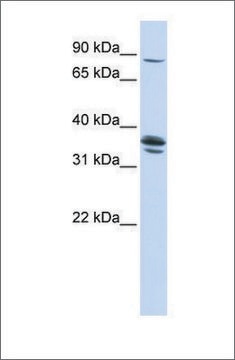 Anti-SLCO3A1 antibody produced in rabbit affinity isolated antibody