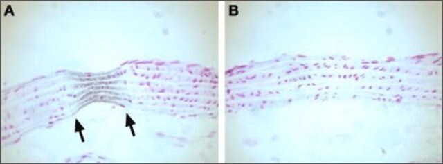 Anti-Calcium Channel (Cardiac &#945;1C Subunit) (L-type of Voltage-gated Ca2+ Channel) antibody produced in rabbit affinity isolated antibody, lyophilized powder