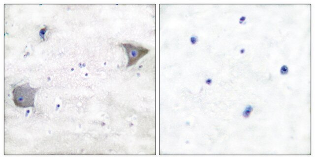 Anti-PDGFR &#945; antibody produced in rabbit affinity isolated antibody