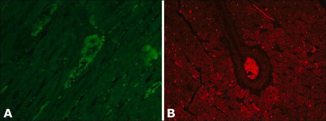 Anti-Vinculin antibody produced in rabbit affinity isolated antibody, buffered aqueous solution