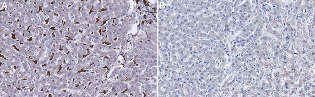 Anti-CD163 Antibody, clone MAC2-158