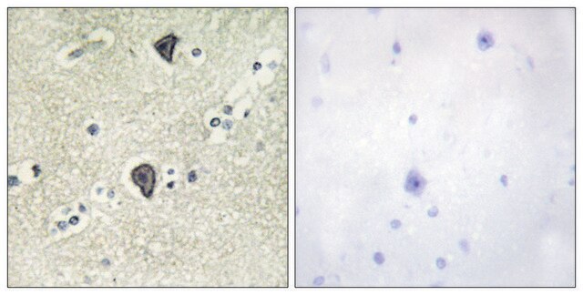 Anti-FGFR3 antibody produced in rabbit affinity isolated antibody