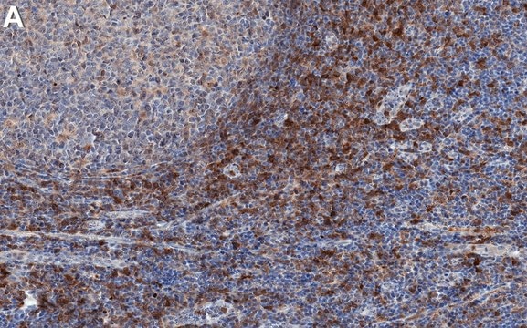 Anti-IRF-5 Antibody, clone 1L11 ZooMAb&#174; Rabbit Monoclonal recombinant, expressed in HEK 293 cells