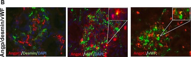 Anti-Desmin Antibody, clone DE-B-5 clone DE-B-5, Chemicon&#174;, from mouse