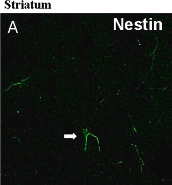 Anti-Nestin-Antikörper, Klon 401 (Ratte) clone rat-401, Chemicon&#174;, from mouse