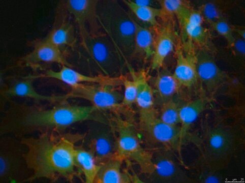 OP9-DL1 hDL-1-Expressing mOP9 Cell Line