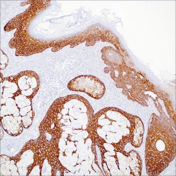 Cytokeratin&nbsp;5 (EP1601Y) Rabbit Monoclonal Primary Antibody