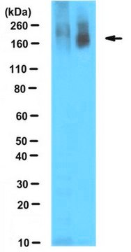 Anti-Poly-ADP-Ribose-Antikörper, Klon 10H clone 10H, from mouse