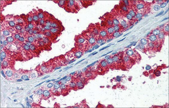 Anti-YAP1 antibody produced in rabbit affinity isolated antibody