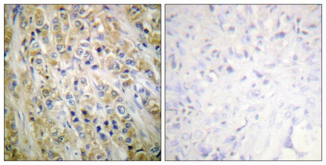 Anti-Prostate-specific Antigen antibody produced in rabbit affinity isolated antibody