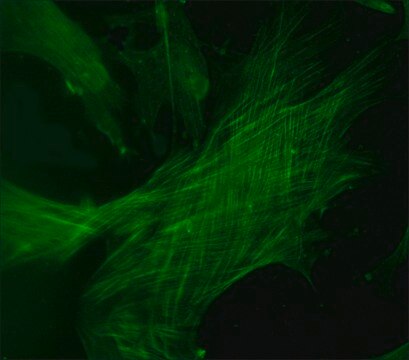 Anti-Tropomyosin antibody produced in rabbit whole antiserum