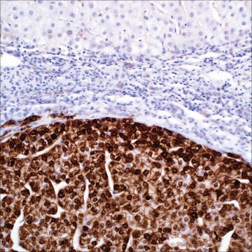 Glutamin-Synthetase (GS-6) Mouse Monoclonal Antibody