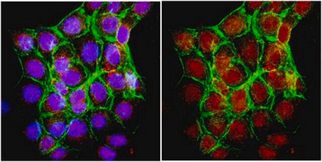 Anti-FOXP3 Antibody serum, from rabbit