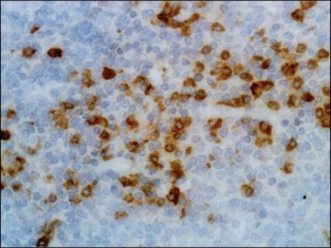 Anti-Human Kappa Light Chain antibody, Rabbit monoclonal recombinant, expressed in HEK 293 cells, clone RM126, purified immunoglobulin