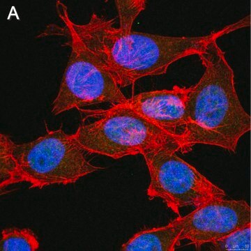 Anti-FoxP3 Antibody, clone 4J2 ZooMAb&#174; Rabbit Monoclonal recombinant, expressed in HEK 293 cells