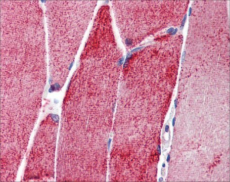 Anti-ACTN3 antibody produced in rabbit affinity isolated antibody