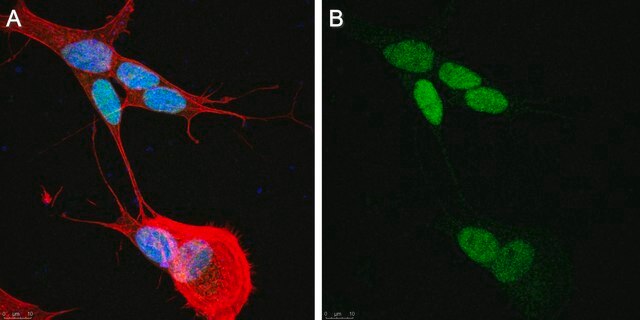 Anti-Sox-11 Antibody, clone SOX11-C1