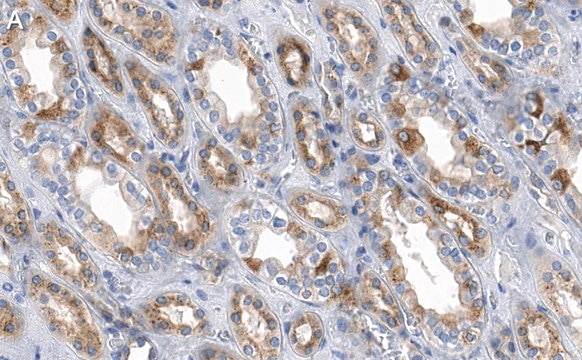 Anti-ACC1 Antibody, clone 1J8 ZooMAb&#174; Rabbit Monoclonal recombinant, expressed in HEK 293 cells