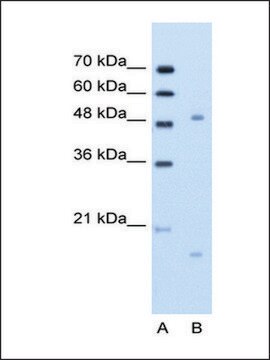 Anti-ITGBL1 (AB1) antibody produced in rabbit IgG fraction of antiserum