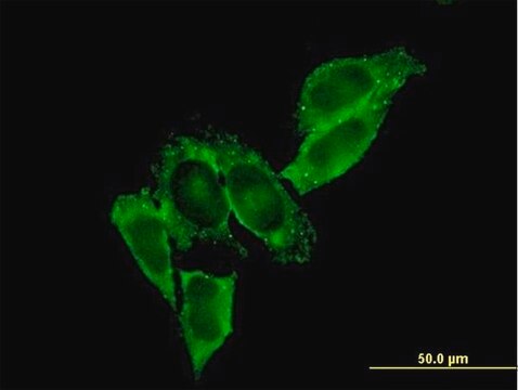 Monoclonal Anti-MMP9 antibody produced in mouse clone 2H4, purified immunoglobulin, buffered aqueous solution