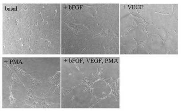 Fibrin In Vitro Angiogenesis Assay The Fibrin Gel In Vitro Angiogenesis Assay Kit represents a simple model of angiogenesis in which the induction or inhibition of tube formation by exogenous signals can be easily monitored.