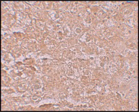 Anti-ZIP14 antibody produced in rabbit affinity isolated antibody, buffered aqueous solution