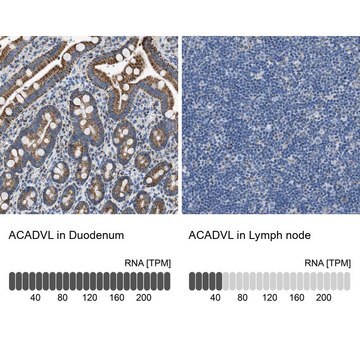 Anti-ACADVL antibody produced in rabbit Prestige Antibodies&#174; Powered by Atlas Antibodies, affinity isolated antibody, buffered aqueous glycerol solution, Ab1