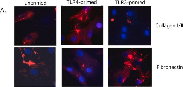 Anti-Collagen Type I Antibody, clone 5D8-G9 clone 5D8-G9, Chemicon&#174;, from mouse