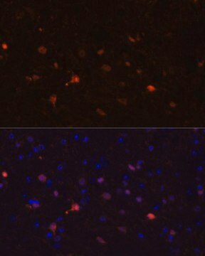 Anti-S100B antibody produced in rabbit