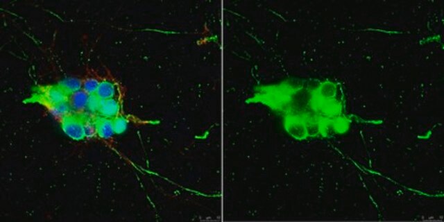 Anti-Nerve Growth Factor Receptor Antibody, p75 serum, Chemicon&#174;