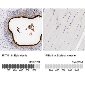 Anti-IFITM1 antibody produced in rabbit Prestige Antibodies&#174; Powered by Atlas Antibodies, affinity isolated antibody, buffered aqueous glycerol solution