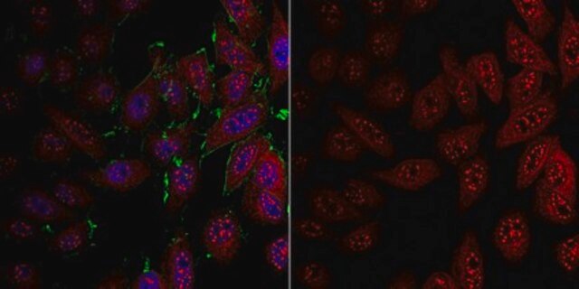 Anti-LDHA from rabbit, purified by affinity chromatography