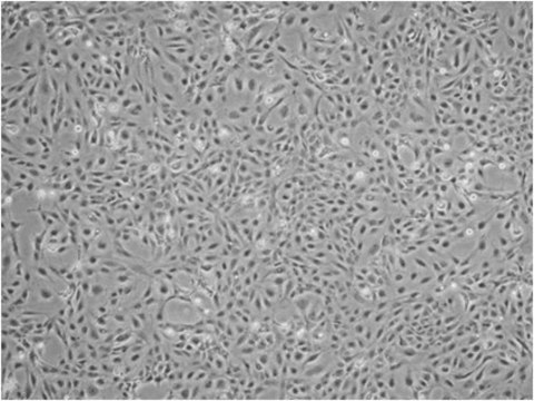 Humane Hepatische Stellat-LX-2-Zelllinie The LX-2 human hepatic stellate cell line has been extensively characterized and retain key features of hepatic stellate cytokine signaling, neuronal gene expression, retinoid metabolism, and fibrogenesis, making them a highly suitable model of human hepatic fibrosis.