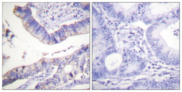 Anti-BCL-2 antibody produced in rabbit affinity isolated antibody