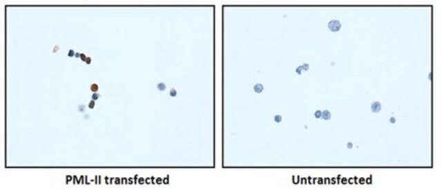 Anti-PML Isoform II Antibody, clone 1A8.1 clone 1A8.1, from mouse