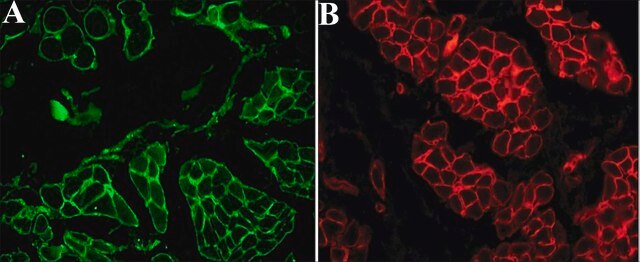 Anti-Laminin antibody, Mouse monoclonal clone LAM-89, purified from hybridoma cell culture