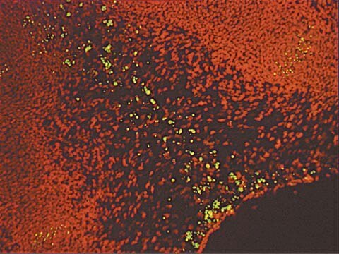 ApopTag Plus In-situ-Apoptose-Fluoreszeinnachweis-Kit The ApopTag Plus Fluorescein In Situ Apoptosis Detection Kit detects apoptotic cells in situ by the indirect TUNEL method, utilizing an anti-digoxigenin antibody that is conjugated to a fluorescein reporter molecule.