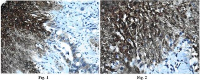 Anti-Laminin subunit alpha-4 Antibody, clone 3H2 clone 3H2, from mouse