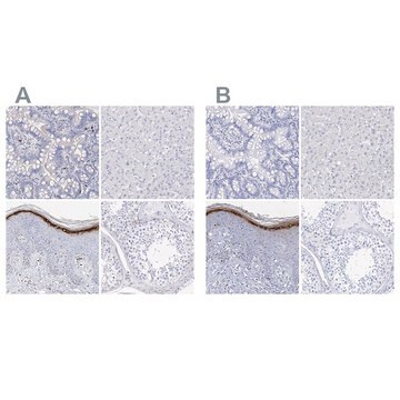 Anti-FLG antibody produced in rabbit Prestige Antibodies&#174; Powered by Atlas Antibodies, affinity isolated antibody, buffered aqueous glycerol solution, ab2