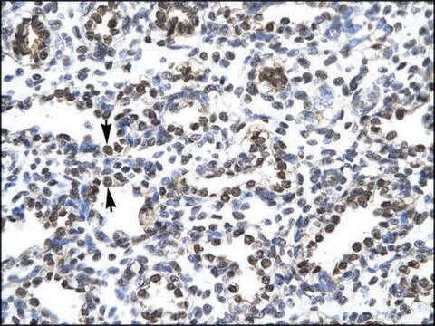 Anti-CIC IgG fraction of antiserum